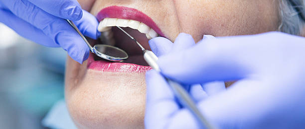 Best Emergency Tooth Extraction in Perezville, TX